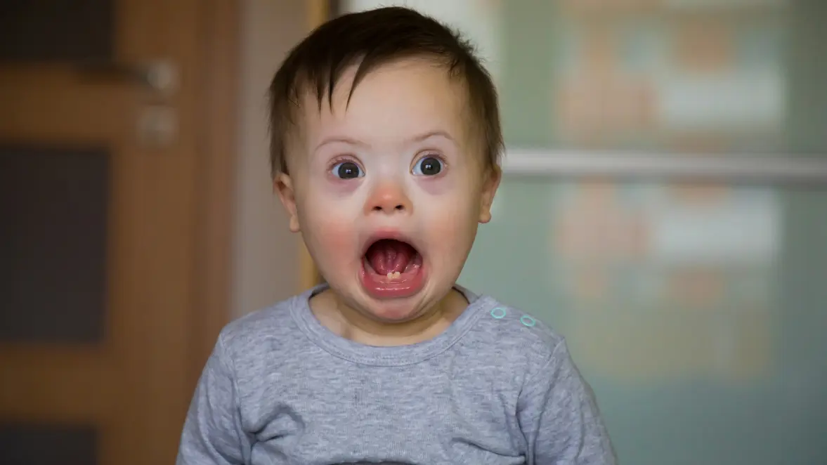 Shaken Baby Syndrome