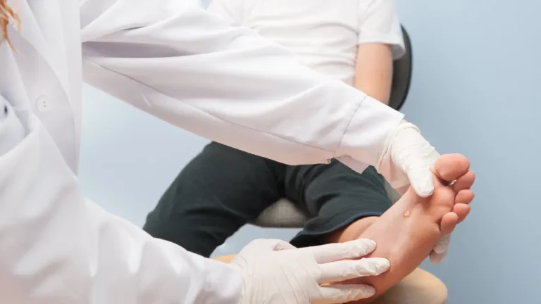 Warts