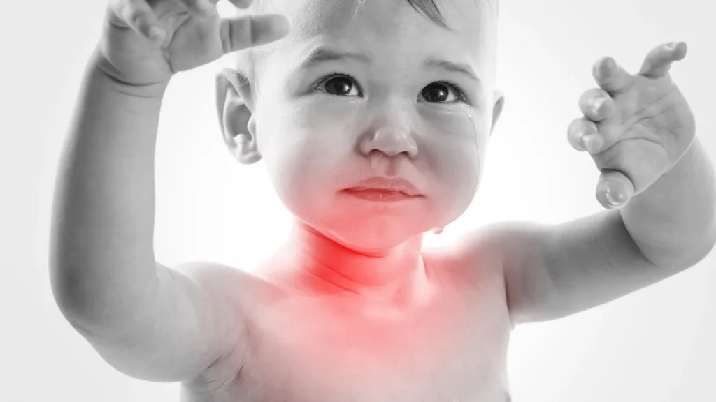 Common Baby Ailments