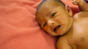 Newborn Jaundice